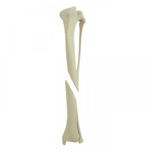Anatomisches Modell / Tibia 1