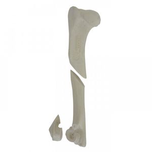 Anatomisches Modell / Humerus 1