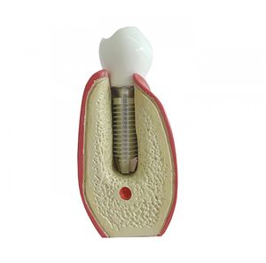 Anatomisches Modell / Dental