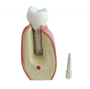 Anatomisches Modell / Dental