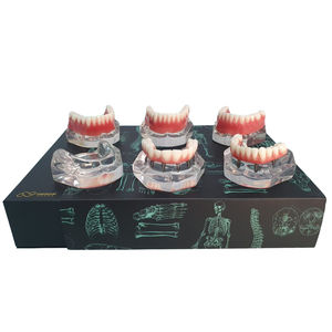 Anatomisches Modell / Unterkiefer 1