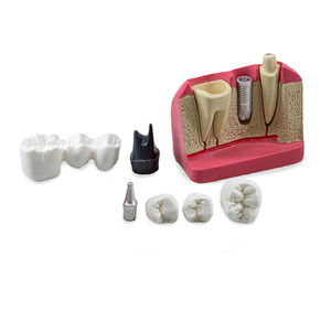 Anatomisches Modell / Dental 1