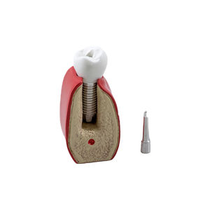 Anatomisches Modell / Dental 1