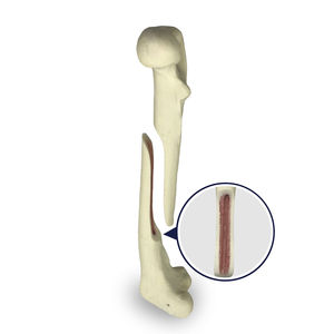 Anatomisches Modell / Oberschenkelknochen 1