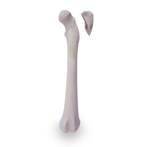 Anatomisches Modell / Oberschenkelknochen 1