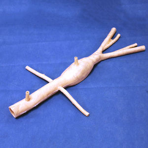 Anatomisches Modell / Aneurysmus der Aorta abdominalis
