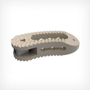 thorako-lumbales Zwischenwirbelimplantat