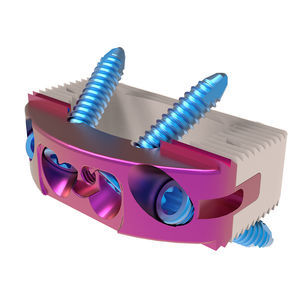 thorako-lumbales Zwischenwirbelimplantat 1
