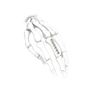 Kompressionsplatte für Hand