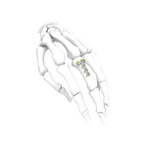 Kompressionsplatte für Hand