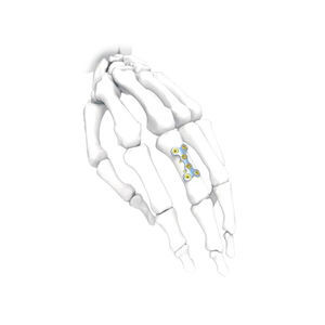 Kompressionsplatte für Hand 1