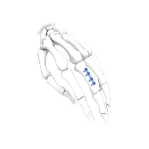 Kompressionsplatte für Hand 1
