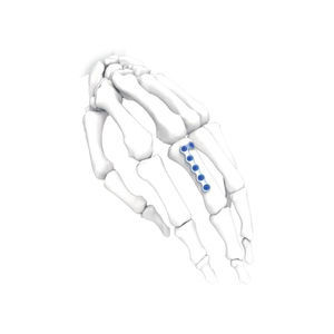 Kompressionsplatte für Hand 1