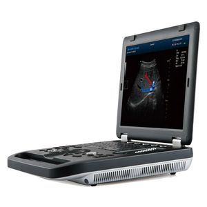 tragbares Ultraschallgerät