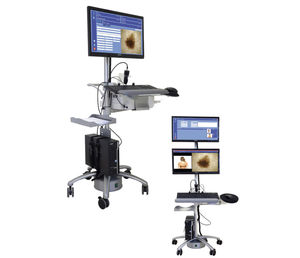 Videodermatoskop 1