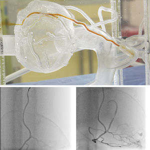 Anatomisches Modell / Koronararterien 1