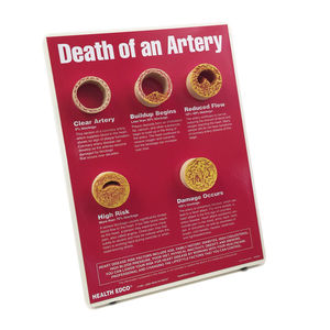 Anatomisches Modell / für Arteriosklerose