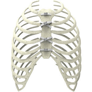 Cerclagekabel für Sternum-Verschluss
