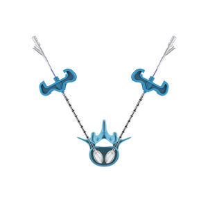 Vertebroplastie-System / Ballonkatheter