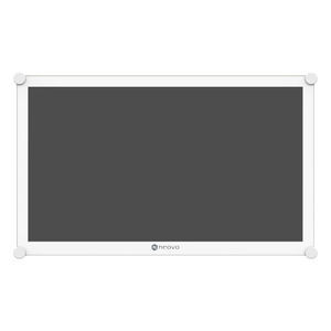 medizinisch Monitor 1