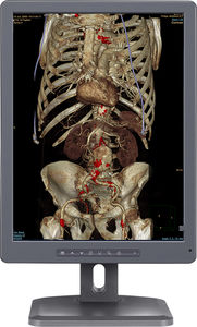 Diagnose-Monitor