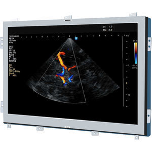 Monitor für Ultraschalluntersuchungen