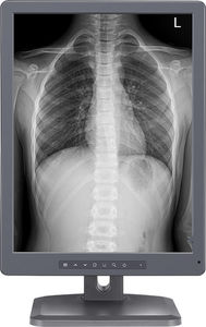Diagnose-Monitor
