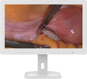 Monitor für Endoskopie