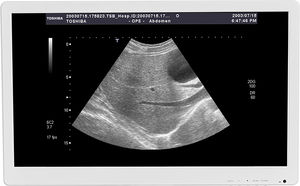 Monitor für Ultraschalluntersuchungen
