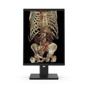 Diagnose-Monitor