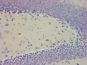 Reagenzkit / Hämatoxylin nach Mayer