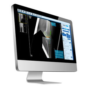 Software für orthopädische Chirurgie