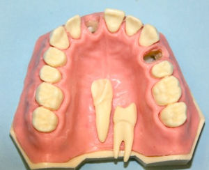 Anatomisches Modell / Oberkiefer 1