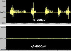 Software für EMG