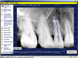 Software für dentale Bildgebung