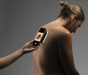 Dermatoskop / weiße LED
