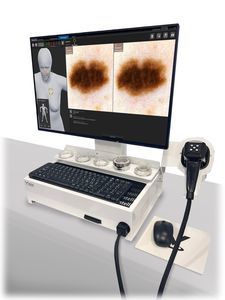 Videodermatoskop 1