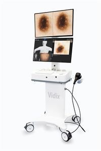 Videodermatoskop 1