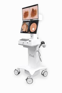 Videodermatoskop