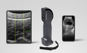 tragbares Tierärztliches Ultraschallsystem