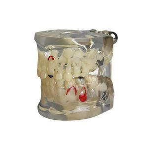 Anatomisches Modell / Zahn 1