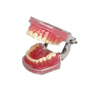 gingivales anatomisches Modell 1