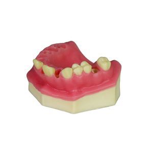 gingivales anatomisches Modell 1