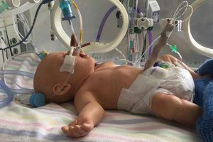 Baby-Patientensimulator 1
