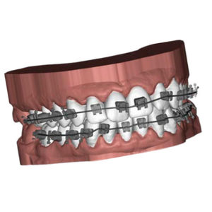 CAD-Software