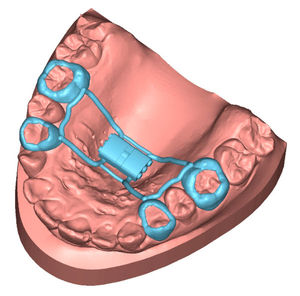 Software für Dentallabor 1