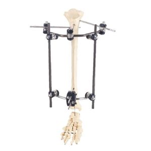 Fixateur externe / für Tibia