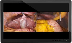 medizinischer Monitor
