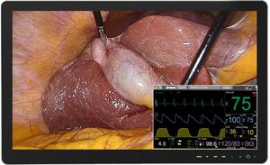 medizinischer Monitor