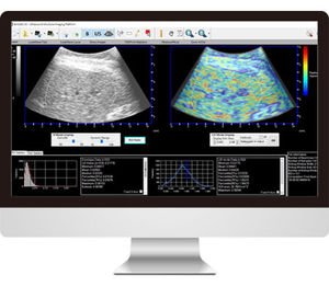 Software für Ultraschall / Visualisierung / Diagnose / Interpretation